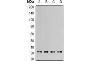Image no. 1 for anti-HCLS1 Associated Protein X-1 (HAX1) antibody (ABIN2966705)