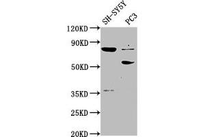 ABLIM1 antibody  (AA 174-319)