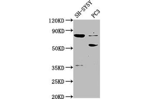 ABLIM1 antibody  (AA 174-319)