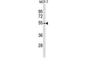Image no. 3 for anti-ADAM-Like, Decysin 1 (ADAMDEC1) (AA 47-76), (N-Term) antibody (ABIN950270)
