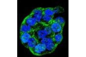 Image no. 3 for anti-Wilms Tumor 1 Interacting Protein (WTIP) (AA 474-503), (C-Term) antibody (ABIN955587)