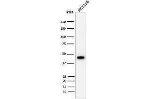 Image no. 6 for anti-Keratin 18 (KRT18) antibody (ABIN6939931)