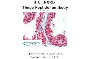 Image no. 1 for anti-Retinoid X Receptor, beta (RXRB) antibody (ABIN1724387)