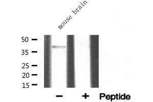 Image no. 3 for anti-Sarcoglycan, alpha (50kDa Dystrophin-Associated Glycoprotein) (SGCA) (Internal Region) antibody (ABIN6258888)