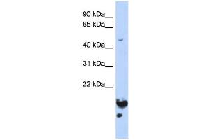 Image no. 1 for anti-Nucleolar and Spindle Associated Protein 1 (NUSAP1) (Middle Region) antibody (ABIN2782569)