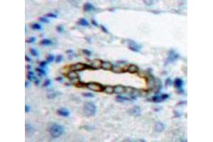 Image no. 2 for anti-Interleukin 20 Receptor beta (IL20RB) (AA 37-290) antibody (ABIN1859401)