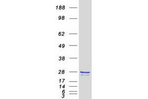 Image no. 1 for Core-Binding Factor, beta Subunit (CBFB) (Transcript Variant 2) protein (Myc-DYKDDDDK Tag) (ABIN2713253)