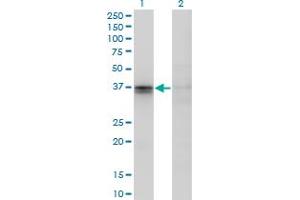 Image no. 6 for anti-F11 Receptor (F11R) (AA 1-299) antibody (ABIN565503)
