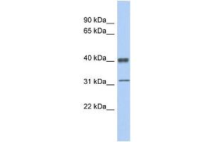 Image no. 4 for anti-Y Box Binding Protein 1 (YBX1) (Middle Region) antibody (ABIN2775773)