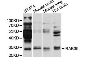 Image no. 1 for anti-RAB35, Member RAS Oncogene Family (RAB35) antibody (ABIN5995506)