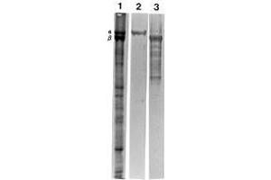 Image no. 1 for anti-Spectrin alpha 1, Erythrocytic (SPTA1) antibody (ABIN108437)