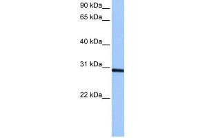 Image no. 1 for anti-Ankyrin Repeat and SOCS Box-Containing 11 (ASB11) (C-Term) antibody (ABIN2784642)