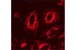 Image no. 2 for anti-Lysosomal-Associated Membrane Protein 1 (LAMP1) antibody (ABIN361797)