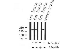 IRS1 Antikörper  (pSer639)