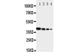 Image no. 3 for anti-V-Erb-A erythroblastic Leukemia Viral Oncogene Homolog 4 (Avian) (ERBB4) (AA 35-51), (N-Term) antibody (ABIN3044100)