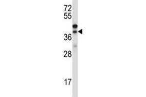 Image no. 1 for anti-Connective Tissue Growth Factor (CTGF) (AA 166-193) antibody (ABIN3030564)