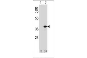 Image no. 2 for anti-Aldo-Keto Reductase Family 1, Member B1 (Aldose Reductase) (AKR1B1) (AA 287-316), (C-Term) antibody (ABIN357880)