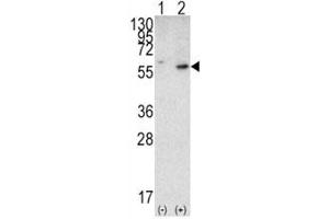 Image no. 3 for anti-Phosphatase and Tensin Homolog (PTEN) (AA 69-104) antibody (ABIN3032214)