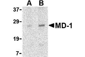 Western Blotting (WB) image for anti-Lymphocyte Antigen 86 (LY86) (Middle Region) antibody (ABIN1030998)
