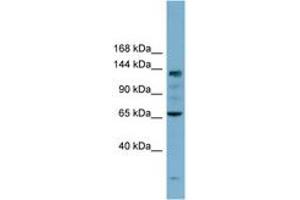 Image no. 1 for anti-Isoleucyl-tRNA Synthetase (IARS) (AA 35-84) antibody (ABIN6741923)