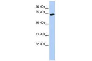 Image no. 1 for anti-Zinc Finger Protein 133 (ZNF133) (AA 180-229) antibody (ABIN6740436)