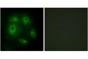 Image no. 2 for anti-Deleted in Lung and Esophageal Cancer 1 (DLEC1) (AA 1-50) antibody (ABIN1534201)