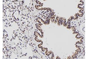 Image no. 3 for anti-Male Germ Cell-Associated Kinase (MAK) (pThr1579) antibody (ABIN6269927)