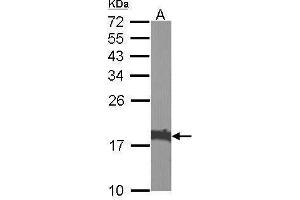 Image no. 5 for anti-Cofilin 1 (CFL1) (Center) antibody (ABIN2855302)