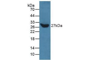 Image no. 2 for anti-Talin (TLN) (AA 975-1181) antibody (ABIN2913741)