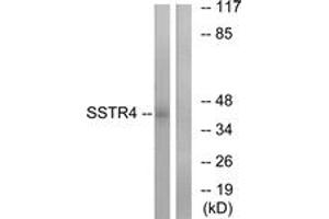 Image no. 1 for anti-Somatostatin Receptor 4 (SSTR4) (AA 155-204) antibody (ABIN1535997)