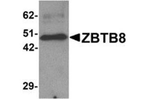 Western blot analysis of ZBTB8 in mouse spleen tissue lysate with ZBTB8 antibody at 1 μg/ml.