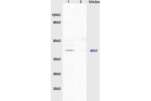 Image no. 3 for anti-Nuclear Receptor Subfamily 1, Group I, Member 2 (NR1I2) (AA 101-150) antibody (ABIN738816)
