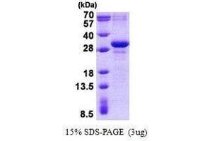 Image no. 1 for MAX Dimerization Protein 3 (MXD3) protein (ABIN2130697)