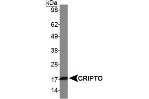 Image no. 3 for anti-Teratocarcinoma-Derived Growth Factor 1 (TDGF1) (AA 100-150) antibody (ABIN363355)