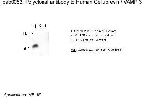 Image no. 2 for anti-Vesicle-Associated Membrane Protein 3 (VAMP3) (N-Term) antibody (ABIN347003)