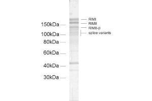 Image no. 1 for anti-Regulating Synaptic Membrane Exocytosis 2 (RIMS2) (AA 461-987) antibody (ABIN1742308)
