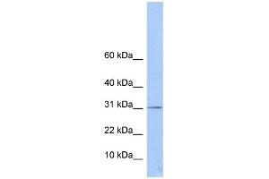 Image no. 1 for anti-Enoyl CoA Hydratase Domain Containing 1 (ECHDC1) (Middle Region) antibody (ABIN2783526)