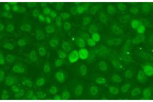 Immunofluorescence analysis of A549 cells using SSNA1 Polyclonal Antibody