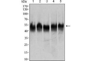 Image no. 2 for anti-Tubulin, beta 2A (TUBB2A) (AA 25-187) antibody (ABIN1724832)