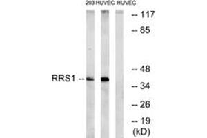 Image no. 1 for anti-RRS1 Ribosome Biogenesis Regulator (RRS1) (AA 254-303) antibody (ABIN1535310)