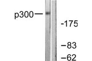 Image no. 1 for anti-E1A Binding Protein P300 (EP300) (AA 1-50) antibody (ABIN1533367)