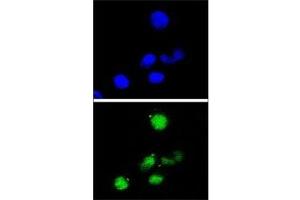 Confocal immunofluorescent analysis of p21 antibody with HepG2 cells followed by Alexa Fluor 488-conjugated goat anti-rabbit lgG (green).