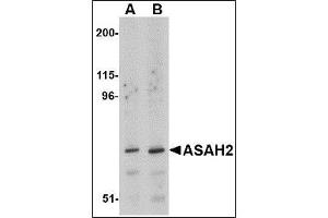 Image no. 1 for anti-N-Acylsphingosine Amidohydrolase (Non-Lysosomal Ceramidase) 2 (ASAH2) (C-Term) antibody (ABIN615690)