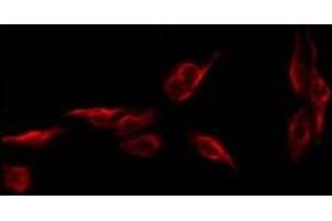 Image no. 2 for anti-NK6 Homeobox 1 (NKX6-1) (Internal Region) antibody (ABIN6263651)