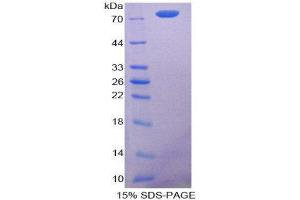 Image no. 1 for Caspase 12 (Gene/pseudogene) (CASP12) (AA 1-413) protein (His tag,GST tag) (ABIN2122558)
