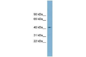Image no. 2 for anti-Zinc Finger, DHHC-Type Containing 18 (ZDHHC18) (Middle Region) antibody (ABIN2775530)