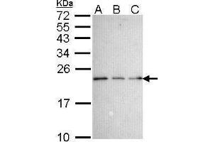 Image no. 2 for anti-Nerve Growth Factor Receptor (TNFRSF16) Associated Protein 1 (NGFRAP1) (Center) antibody (ABIN2855376)