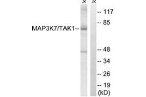 Image no. 2 for anti-Mitogen-Activated Protein Kinase Kinase Kinase 7 (MAP3K7) (AA 161-210) antibody (ABIN1533087)