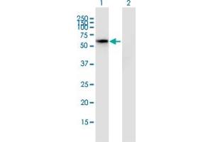 Image no. 1 for anti-HSPB (Heat Shock 27kDa) Associated Protein 1 (HSPBAP1) (AA 1-488) antibody (ABIN528993)
