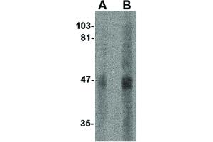Image no. 2 for anti-Sirtuin 2 (SIRT2) (N-Term) antibody (ABIN6656502)